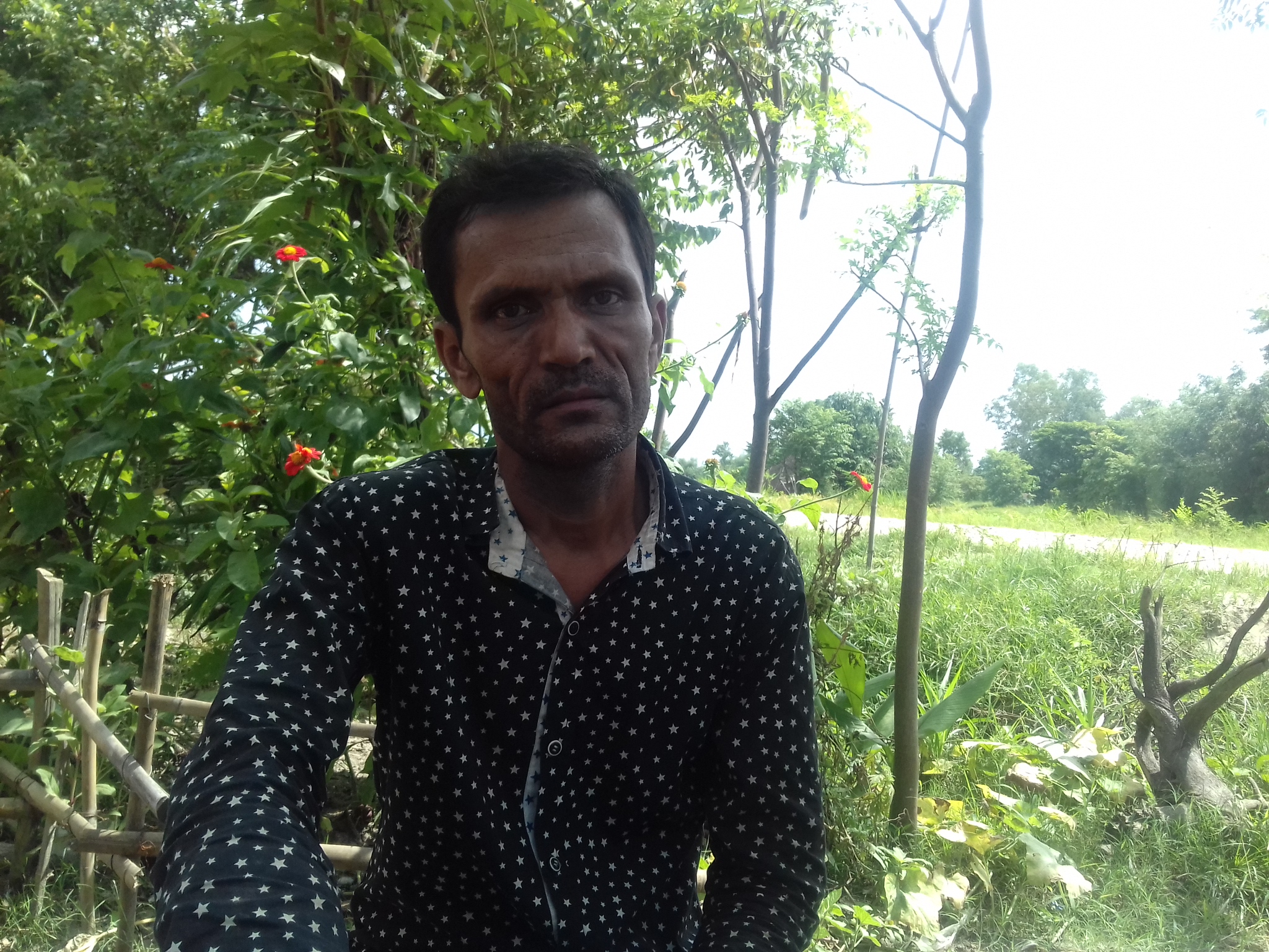 हडडीको टयुमर भइ उपचाररत तिर्थको जिवन बचाउन अपिल