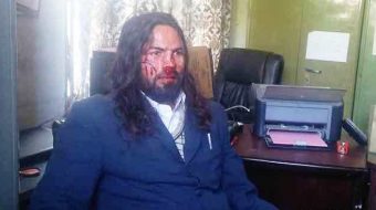 कार्यकक्षमै युवा संघ उपाध्यक्षले कुटे नगरपालिकाका कर्मचारी