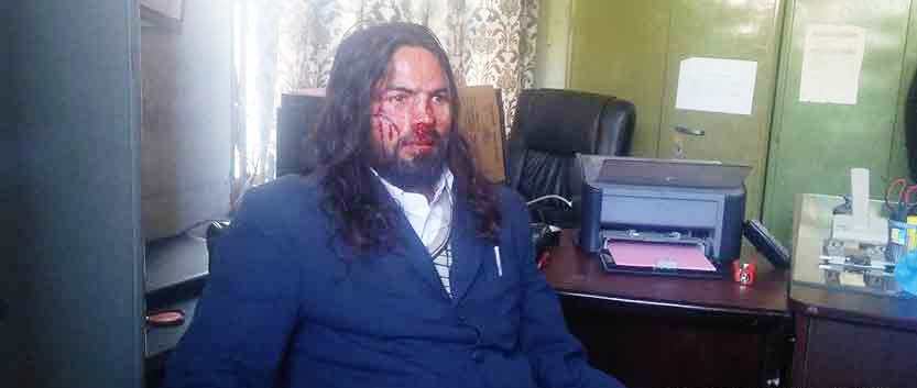 कार्यकक्षमै युवा संघ उपाध्यक्षले कुटे नगरपालिकाका कर्मचारी